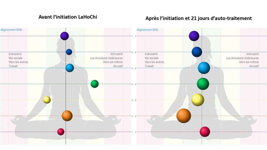 Image des chakras caméra biowell